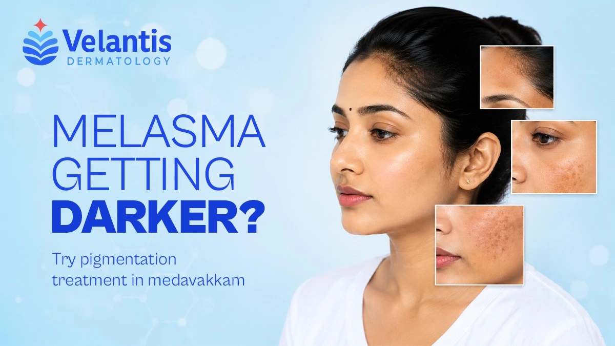 Is Melasma Getting Worse Over Time? What Happens If You Delay Treatment? Is Melasma Getting Worse Over Time? What Happens If You Delay Treatment?