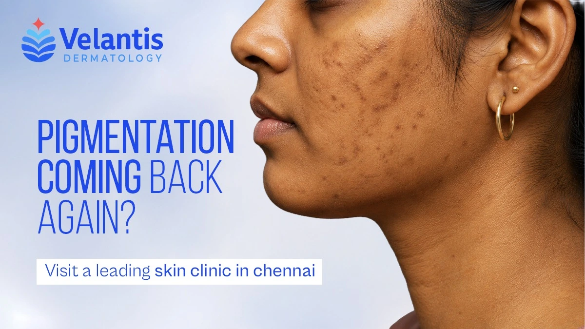 Why Is Pigmentation Returning Even After Successful Treatment?