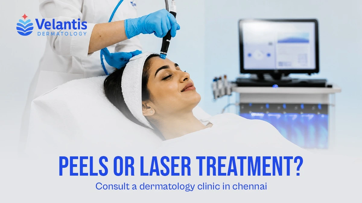 Can Chemical Peels Remove Pigmentation or Do You Need Laser Treatment?