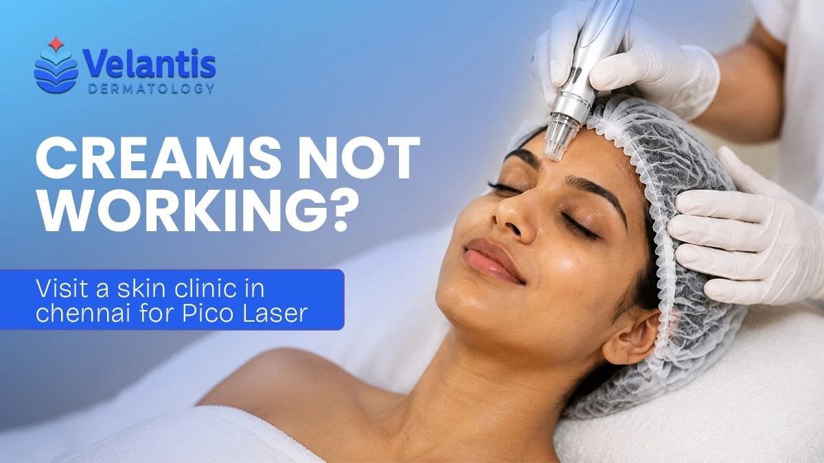 Can Pico Laser Treat Stubborn Pigmentation That Creams Cannot Fix?
