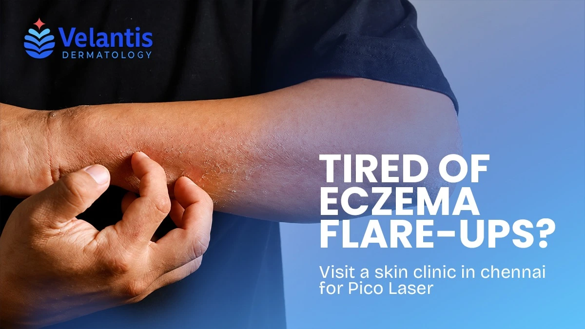Why Does Eczema Keep Flaring Up Despite Following a Skincare Routine?