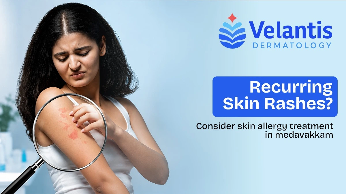 Are Recurring Skin Rashes a Sign You Need Dermatologist Evaluation? Are Recurring Skin Rashes a Sign You Need Dermatologist Evaluation?