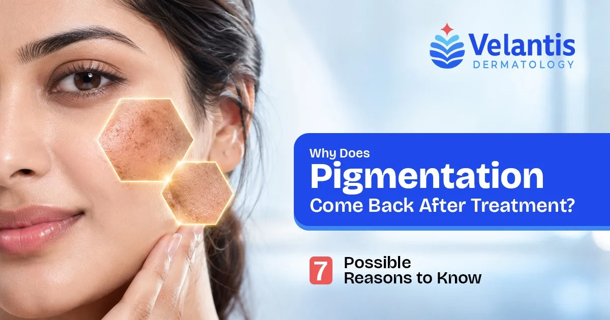 Why Does Pigmentation Come Back After Treatment? 7 Possible Reasons Why Does Pigmentation Come Back After Treatment? 7 Possible Reasons