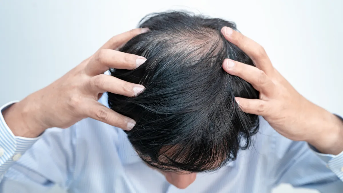 Men's Hair Loss Treatment Options and Solutions