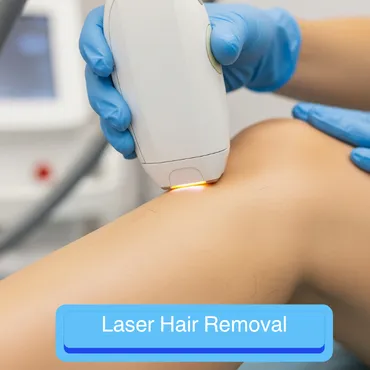 Laser Hair Removal